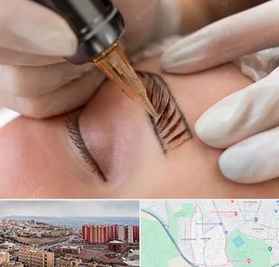 میکروبلیدینگ در سهند تبریز