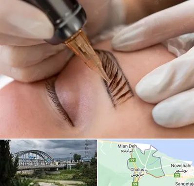 میکروبلیدینگ در چالوس