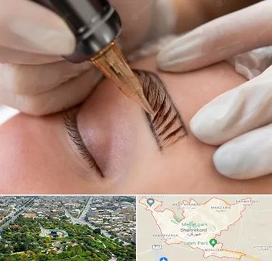 میکروبلیدینگ در شهرکرد