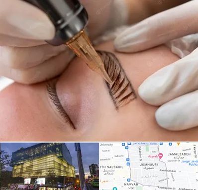 میکروبلیدینگ در جمهوری