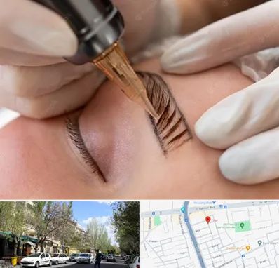 میکروبلیدینگ در کوی فیروز تبریز