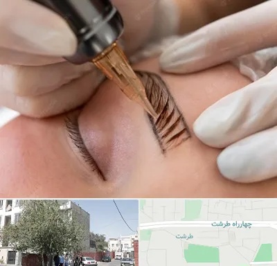 میکروبلیدینگ در طرشت