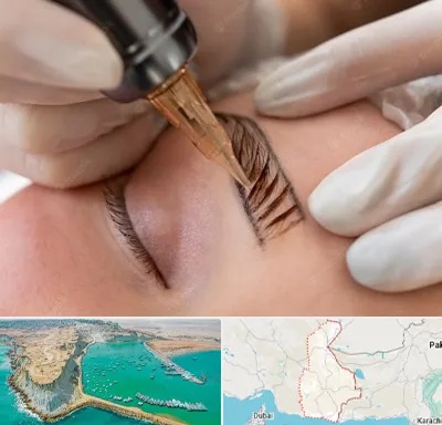 میکروبلیدینگ در سیستان و بلوچستان