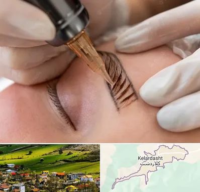 میکروبلیدینگ در کلاردشت