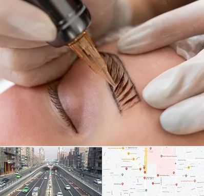 میکروبلیدینگ در توحید