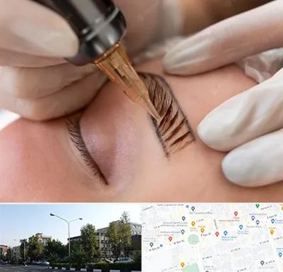 میکروبلیدینگ در میدان کاج