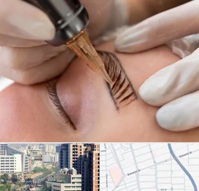 میکروبلیدینگ در خیابان بهشتی