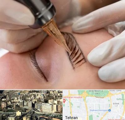 میکروبلیدینگ در مرزداران