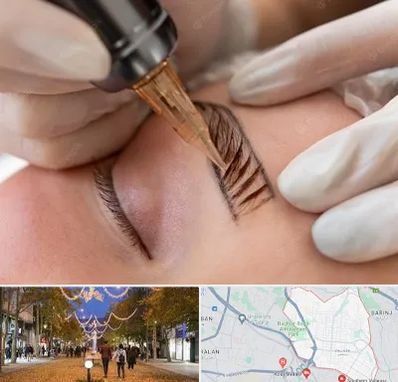 میکروبلیدینگ در ولیعصر ارومیه