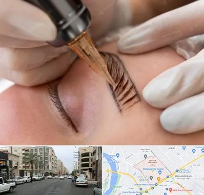 میکروبلیدینگ در زیتون کارمندی اهواز