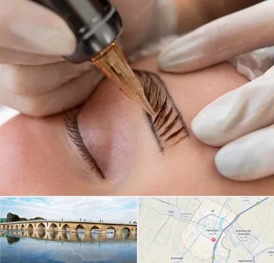 میکروبلیدینگ در فلاورجان