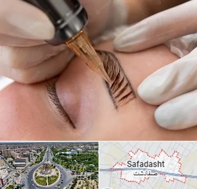 میکروبلیدینگ در صفادشت