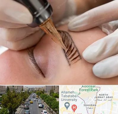 میکروبلیدینگ در شهران