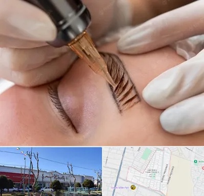 میکروبلیدینگ در فاز دو اندیشه