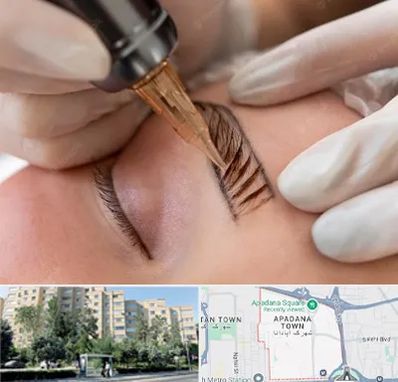 میکروبلیدینگ در آپادانا