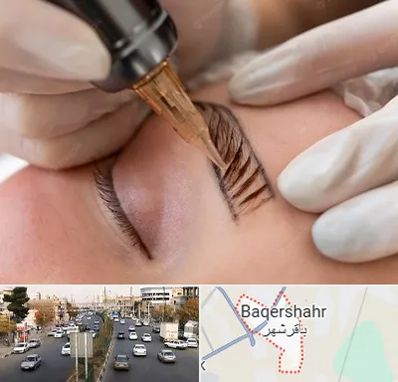 میکروبلیدینگ در باقرشهر