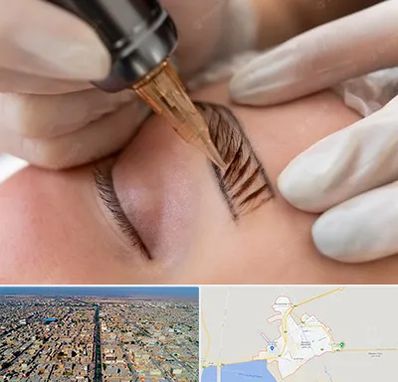 میکروبلیدینگ در بندر ماهشهر