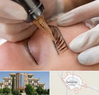 میکروبلیدینگ در دهدشت