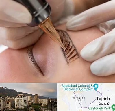 میکروبلیدینگ در زعفرانیه