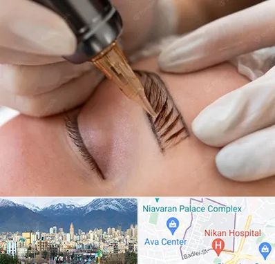 میکروبلیدینگ در آجودانیه