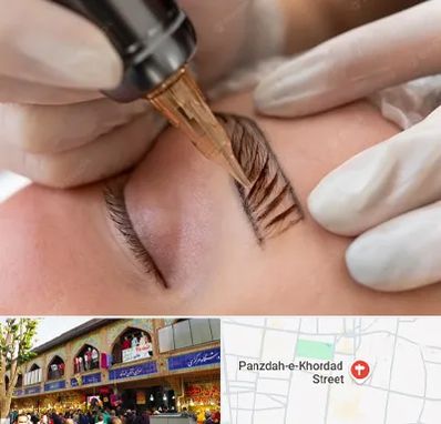 میکروبلیدینگ در 15 خرداد