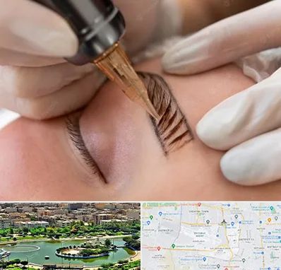 میکروبلیدینگ در منطقه 9 تهران