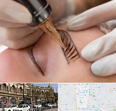 میکروبلیدینگ در منطقه 11 تهران