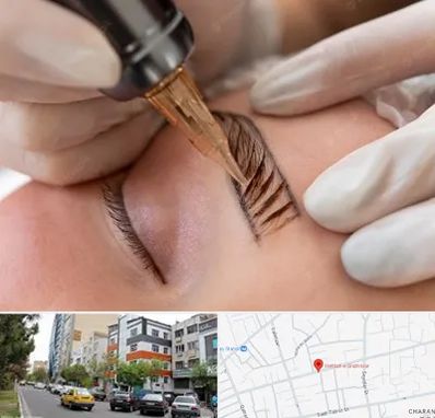 میکروبلیدینگ در هفده شهریور تبریز