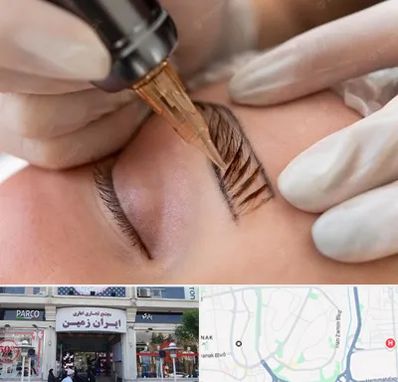 میکروبلیدینگ در ایران زمین