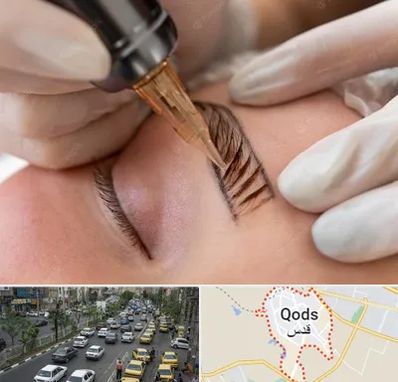 میکروبلیدینگ در شهر قدس