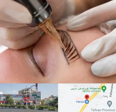 میکروبلیدینگ در هروی