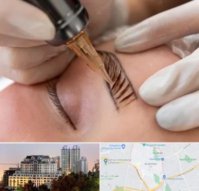 میکروبلیدینگ در فرشته