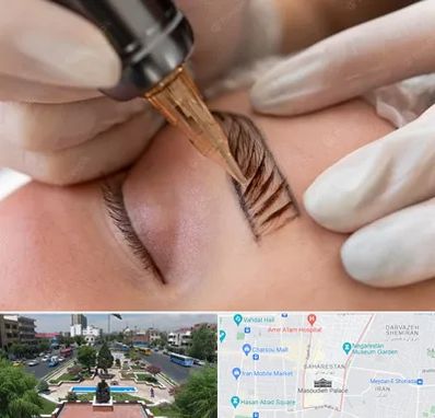 میکروبلیدینگ در بهارستان