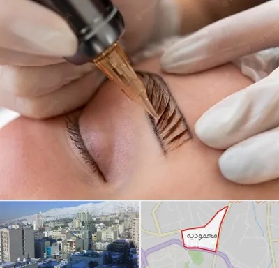 میکروبلیدینگ در محمودیه