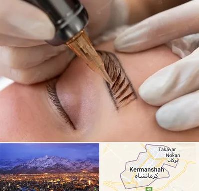 میکروبلیدینگ در کرمانشاه