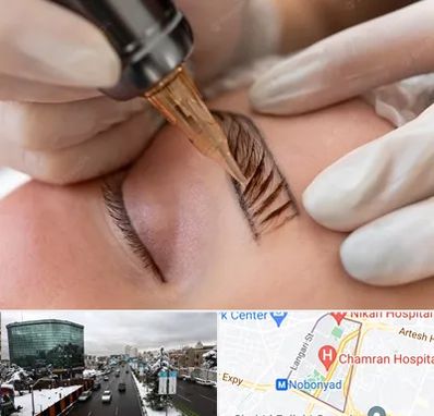 میکروبلیدینگ در اقدسیه