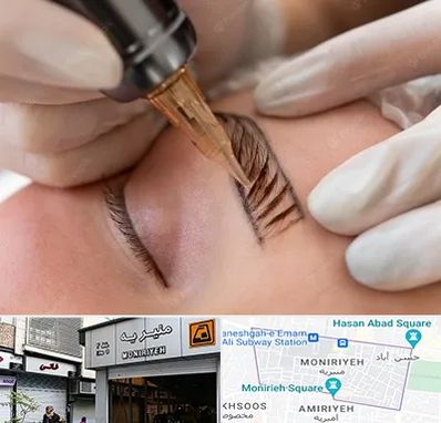 میکروبلیدینگ در منیریه