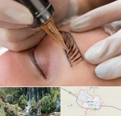 میکروبلیدینگ در شیروان