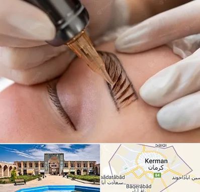 میکروبلیدینگ در کرمان