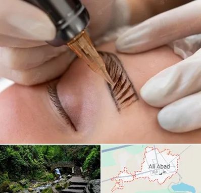 میکروبلیدینگ در علی آباد کتول