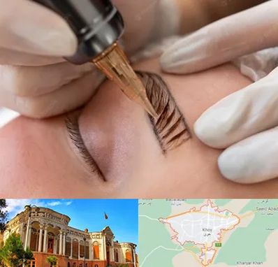 میکروبلیدینگ در خوی