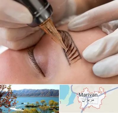 میکروبلیدینگ در مریوان