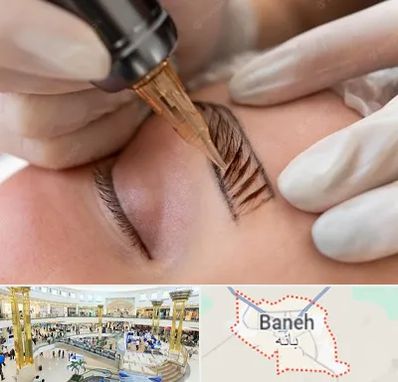 میکروبلیدینگ در بانه