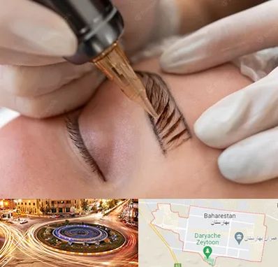 میکروبلیدینگ در بهارستان