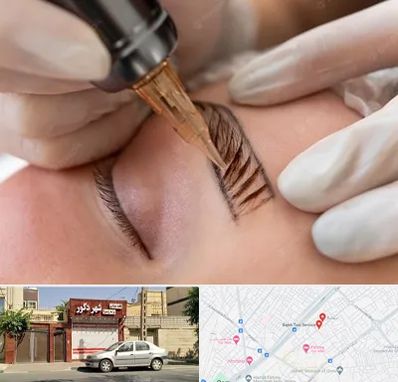 میکروبلیدینگ در باجک قم