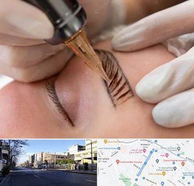 میکروبلیدینگ در خیابان ملاصدرا شیراز