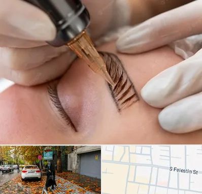 میکروبلیدینگ در خیابان فلسطین