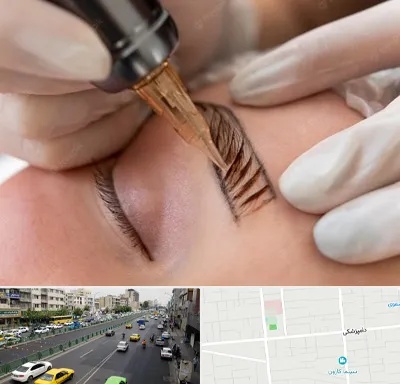 میکروبلیدینگ در خیابان دامپزشکی