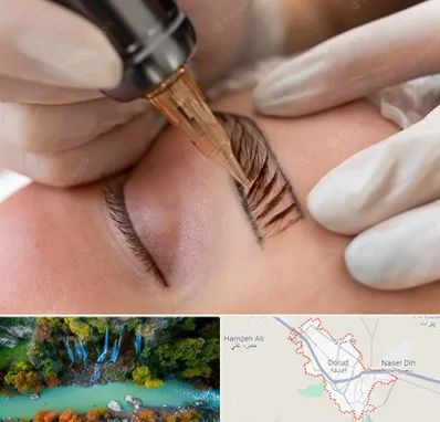 میکروبلیدینگ در دورود