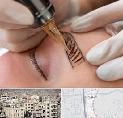 میکروبلیدینگ در اسکندری